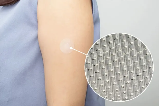 医療用マイクロニードルパッチ（溶解型）